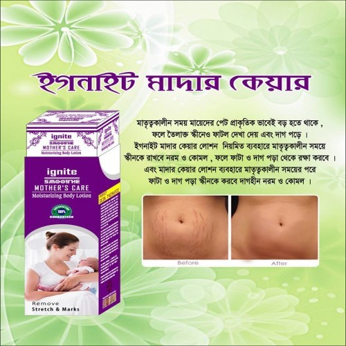 Ignite Mother Care Lotion