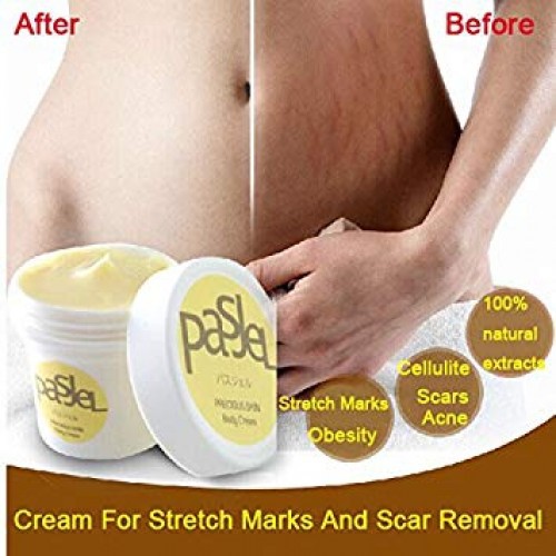 Suukee Pasjel Cream,Thailand PASJEL Stretch Marks