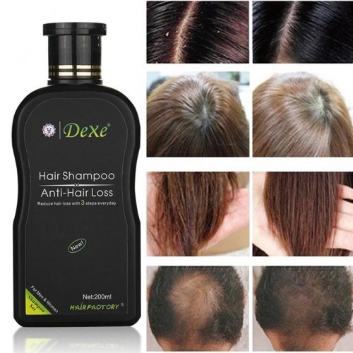 Dexe Anti Hair Loss Shampoo - 200ml