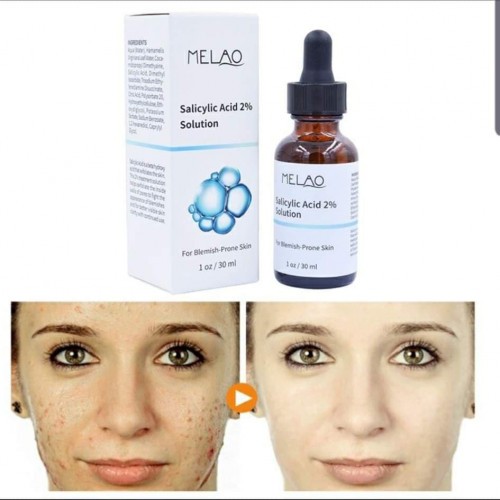 Melao Salicylic Acid 2 Solution