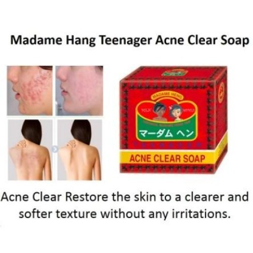 Madame Heng Acne Clear Soap Best Price in Bangladesh