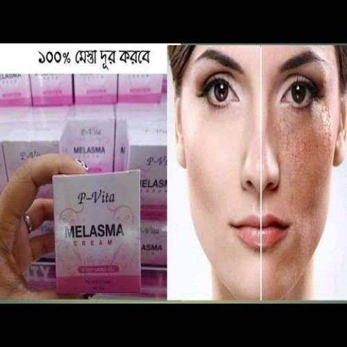 P Vita Melasma Cream