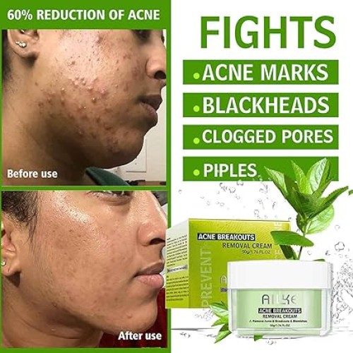AILKE Acne Breakouts Removal Cream 50g