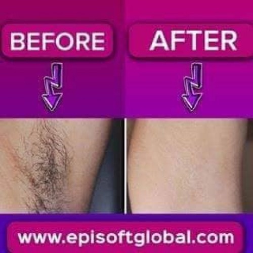 Episoft Hair   price in Bangladesh