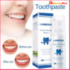 lanbena-teeth-whitening-mousse (2)