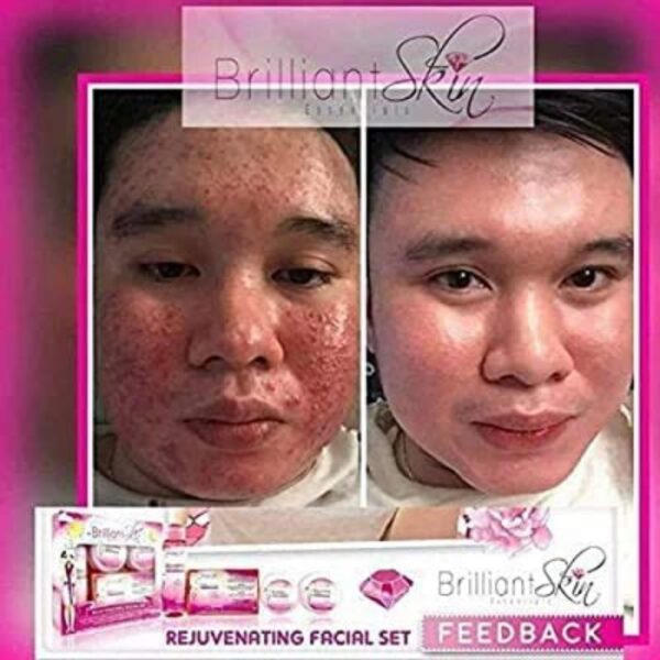 brilliant-rejuvenating-facial-set (3)