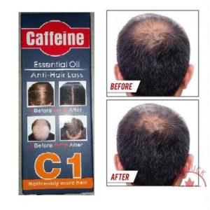Caffeine-Hair-Loss-Essential-Oil-2