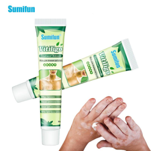 Sumifun-New-Vitiligo-Treatment-Ointment-2