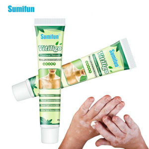 Sumifun-New-Vitiligo-Treatment-Ointment-Best-Product-1