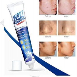 Wart-Remover-Ointment-Cream-1