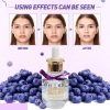 Fruit-Of-Wokali-Blueberry-Serum-Moisturising-Anti-Wrinkle-Anti-Aging-Serum-40ml-1