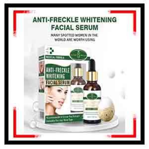 Anti-freckle-Whitening-Serum-Green-Tea-Extract-Moisturizing-Vitamin-E-Remove-Scars-Face-Serum-1.